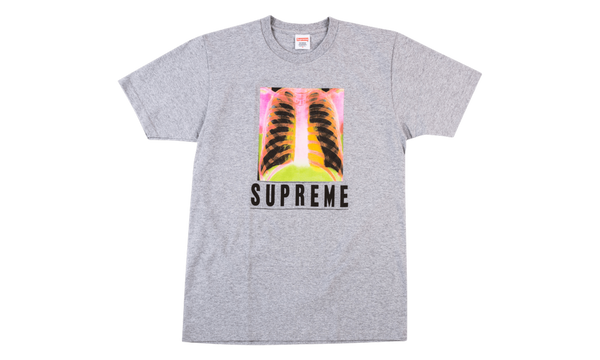 X-Ray Tee