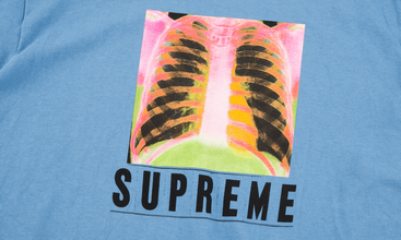 X-Ray Tee