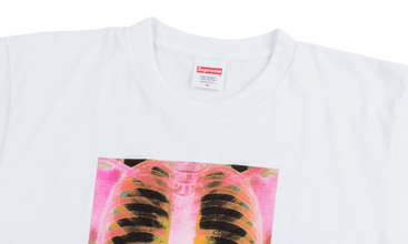 X-Ray Tee