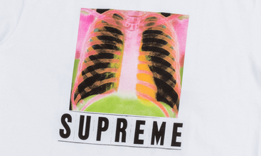 X-Ray Tee