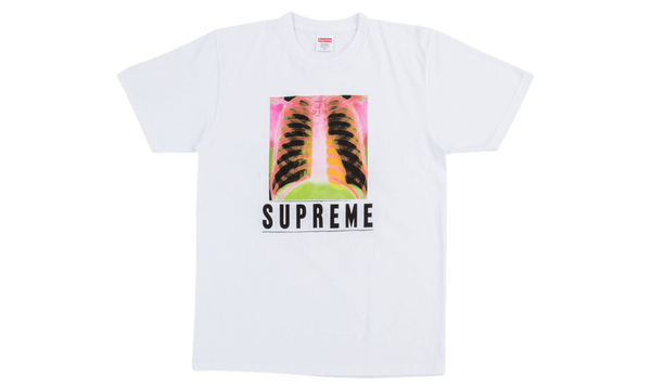 X-Ray Tee