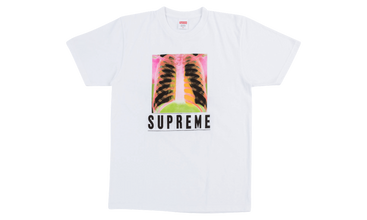 X-Ray Tee