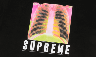 X-Ray Tee