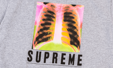 X-Ray Tee